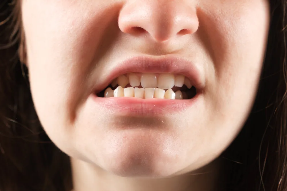 Close-up of clenched teeth